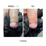 Olejek-regenerujacy-przy-onycholizie-NAILSOFTHEDAY-Onistop-8-ml_[2637]_1200