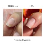 Olejek-regenerujacy-przy-onycholizie-NAILSOFTHEDAY-Onistop-8-ml_[2637]_1200